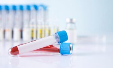 柳田康友はCell Exosome Therapeutics代表!経歴/人物像/活動実績を紹介